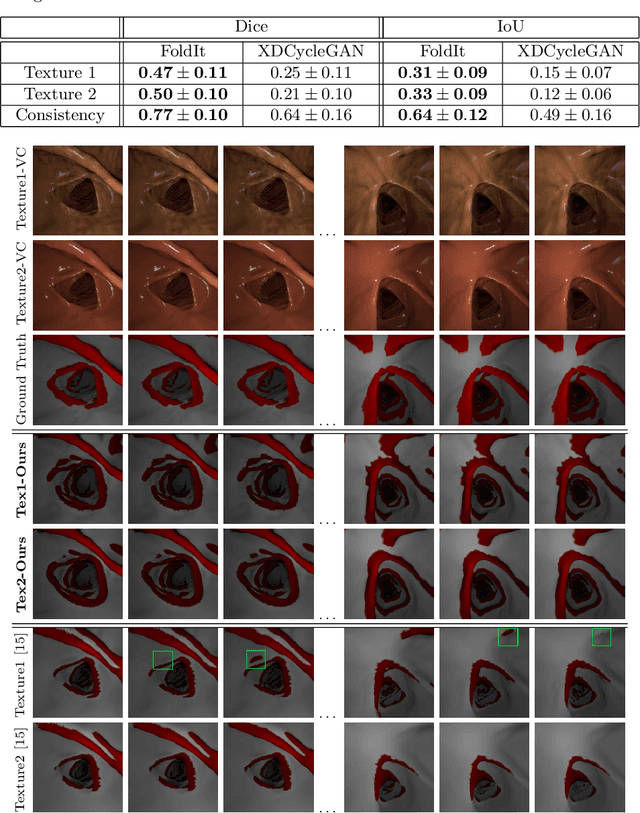 Figure 2 for FoldIt: Haustral Folds Detection and Segmentation in Colonoscopy Videos