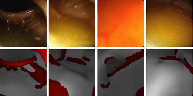 Figure 4 for FoldIt: Haustral Folds Detection and Segmentation in Colonoscopy Videos