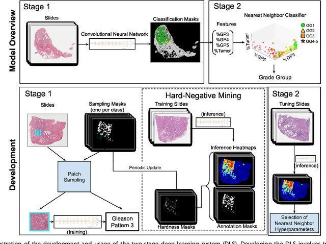 Figure 1 for Development and Validation of a Deep Learning Algorithm for Improving Gleason Scoring of Prostate Cancer