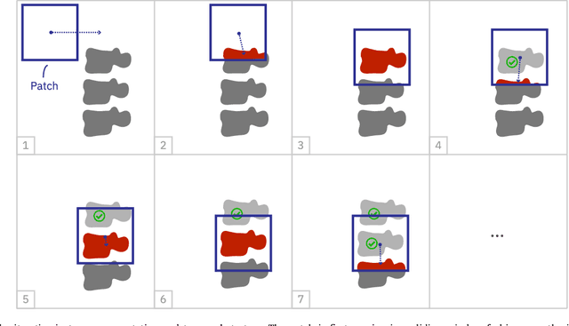 Figure 3 for Iterative fully convolutional neural networks for automatic vertebra segmentation