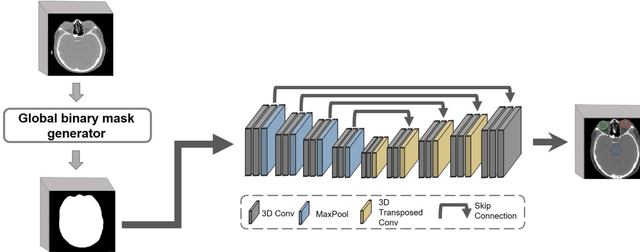 Figure 1 for Leveraging Global Binary Masks for Structure Segmentation in Medical Images