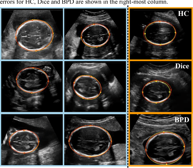 Figure 2 for Human-level Performance On Automatic Head Biometrics In Fetal Ultrasound Using Fully Convolutional Neural Networks