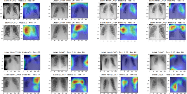 Figure 3 for Optimising Chest X-Rays for Image Analysis by Identifying and Removing Confounding Factors