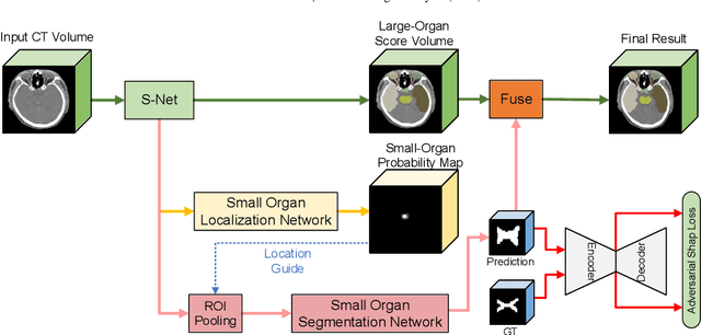 Figure 3 for FocusNetv2: Imbalanced Large and Small Organ Segmentation with Adversarial Shape Constraint for Head and Neck CT Images