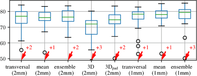 Figure 3 for Comparison of U-net-based Convolutional Neural Networks for Liver Segmentation in CT