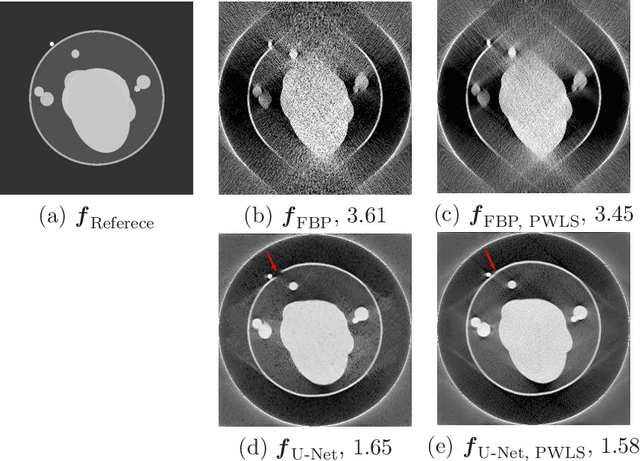 Figure 4 for Limited Angle Tomography for Transmission X-Ray Microscopy Using Deep Learning