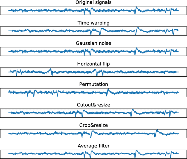 Figure 2 for Self-supervised Contrastive Learning for EEG-based Sleep Staging
