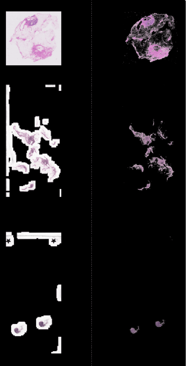 Figure 4 for Magnifying Networks for Images with Billions of Pixels