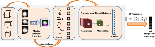 Figure 1 for TumorNet: Lung Nodule Characterization Using Multi-View Convolutional Neural Network with Gaussian Process