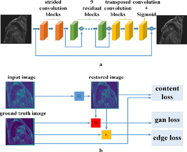 Figure 4 for CMR motion artifact correction using generative adversarial nets