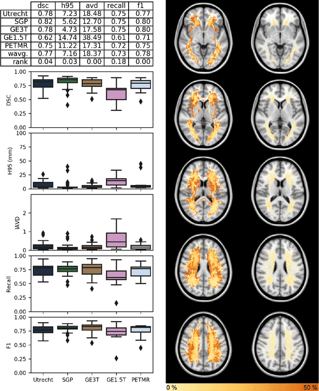 Figure 2 for Standardized Assessment of Automatic Segmentation of White Matter Hyperintensities and Results of the WMH Segmentation Challenge