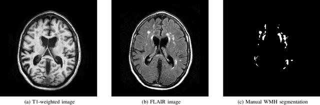 Figure 1 for Standardized Assessment of Automatic Segmentation of White Matter Hyperintensities and Results of the WMH Segmentation Challenge