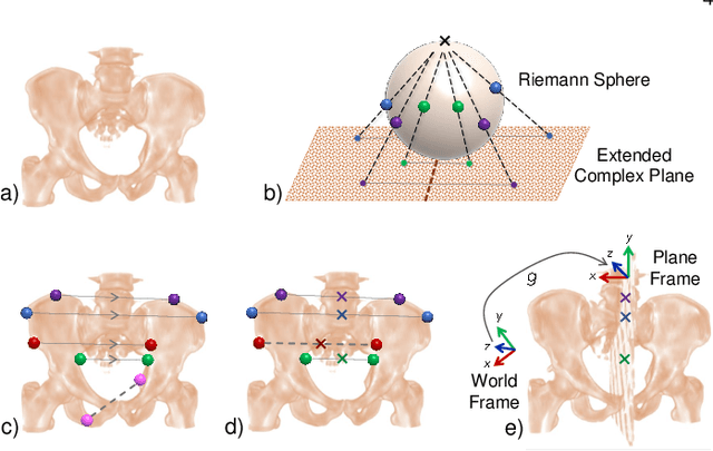 Figure 3 for Exploring Partial Intrinsic and Extrinsic Symmetry in 3D Medical Imaging