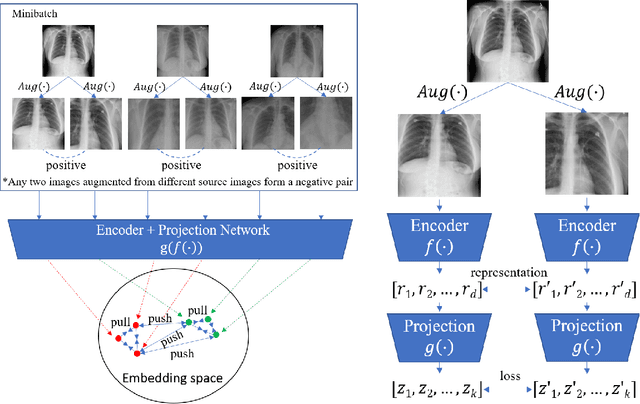 Figure 1 for Representative Image Feature Extraction via Contrastive Learning Pretraining for Chest X-ray Report Generation