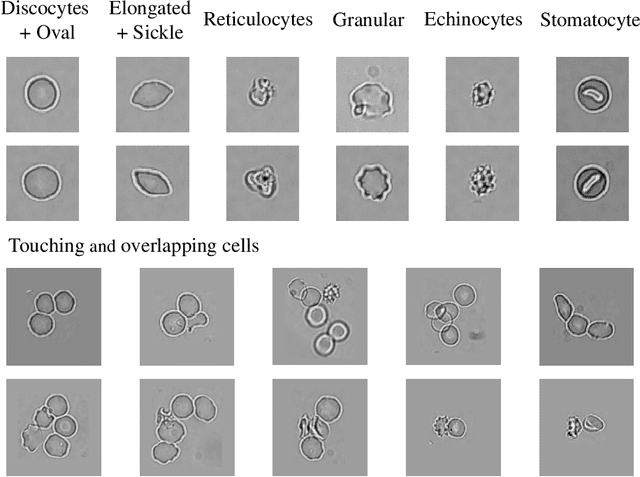 Figure 1 for Multi-label Detection and Classification of Red Blood Cells in Microscopic Images