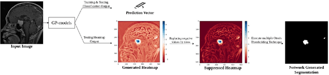 Figure 1 for Weakly-supervised segmentation using inherently-explainable classification models and their application to brain tumour classification