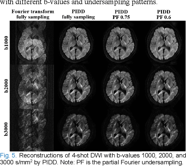 Figure 3 for Physics-informed deep diffusion MRI reconstruction: break the bottleneck of training data in artificial intelligence