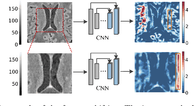 Figure 3 for NeRD: Neural Representation of Distribution for Medical Image Segmentation