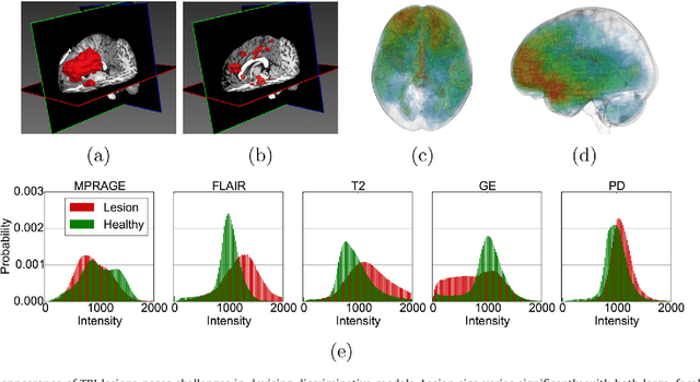 Figure 1 for Efficient Multi-Scale 3D CNN with Fully Connected CRF for Accurate Brain Lesion Segmentation