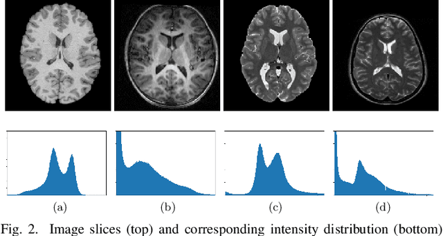 Figure 2 for Domain Adaptation for Medical Image Analysis: A Survey