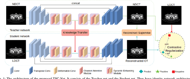 Figure 1 for Total-Body Low-Dose CT Image Denoising using Prior Knowledge Transfer Technique with Contrastive Regularization Mechanism