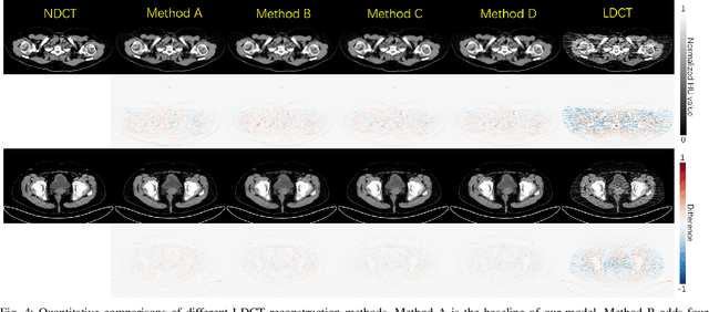Figure 4 for Total-Body Low-Dose CT Image Denoising using Prior Knowledge Transfer Technique with Contrastive Regularization Mechanism
