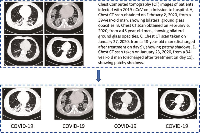 Figure 1 for COVID-CT-Dataset: A CT Scan Dataset about COVID-19