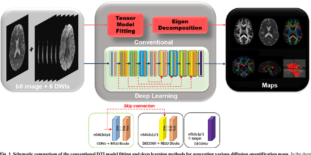 Figure 1 for Deep Learning for Highly Accelerated Diffusion Tensor Imaging
