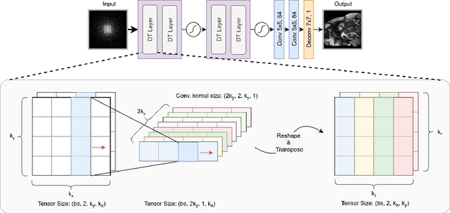 Figure 1 for dAUTOMAP: decomposing AUTOMAP to achieve scalability and enhance performance