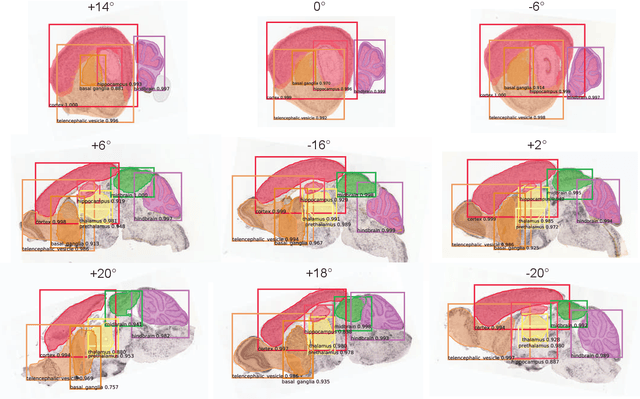 Figure 4 for Developing Brain Atlas through Deep Learning