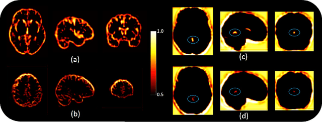 Figure 2 for MRI to PET Cross-Modality Translation using Globally and Locally Aware GAN (GLA-GAN) for Multi-Modal Diagnosis of Alzheimer's Disease