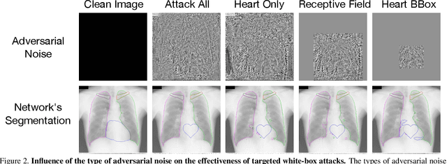 Figure 2 for Adversarial Heart Attack: Neural Networks Fooled to Segment Heart Symbols in Chest X-Ray Images
