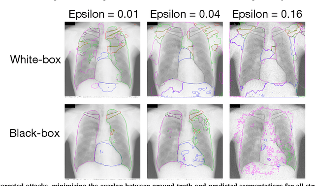 Figure 4 for Adversarial Heart Attack: Neural Networks Fooled to Segment Heart Symbols in Chest X-Ray Images