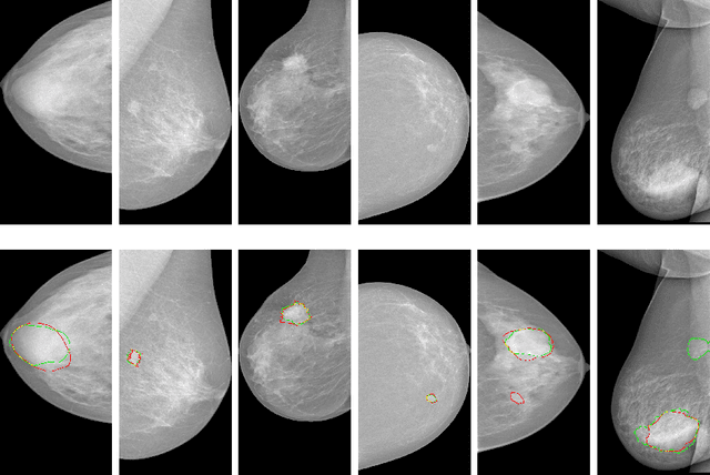 Figure 4 for A Unified Mammogram Analysis Method via Hybrid Deep Supervision