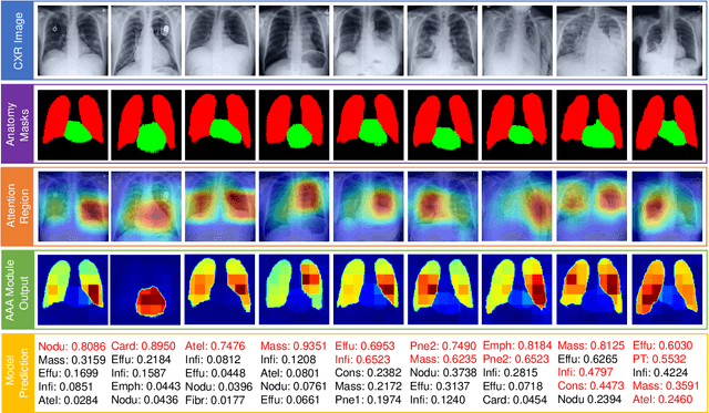 Figure 4 for Anatomy X-Net: A Semi-Supervised Anatomy Aware Convolutional Neural Network for Thoracic Disease Classification