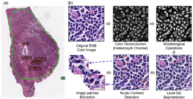 Figure 2 for ConvPath: A Software Tool for Lung Adenocarcinoma Digital Pathological Image Analysis Aided by Convolutional Neural Network