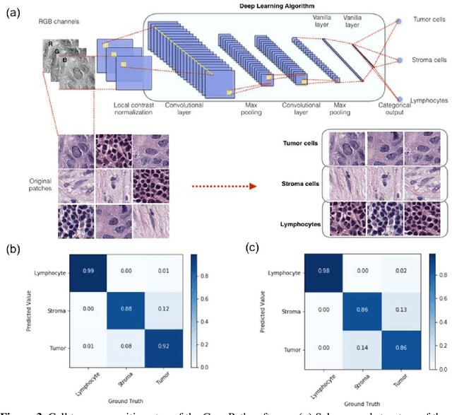 Figure 3 for ConvPath: A Software Tool for Lung Adenocarcinoma Digital Pathological Image Analysis Aided by Convolutional Neural Network