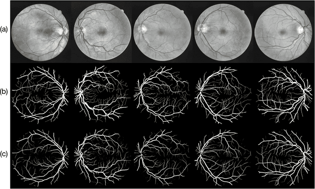 Figure 3 for Auto-Classification of Retinal Diseases in the Limit of Sparse Data Using a Two-Streams Machine Learning Model