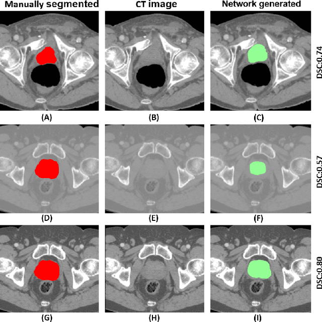 Figure 3 for Cross-modality Knowledge Transfer for Prostate Segmentation from CT Scans