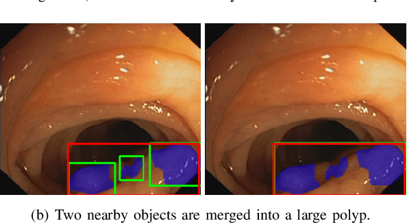 Figure 4 for Colorectal Polyp Segmentation by U-Net with Dilation Convolution