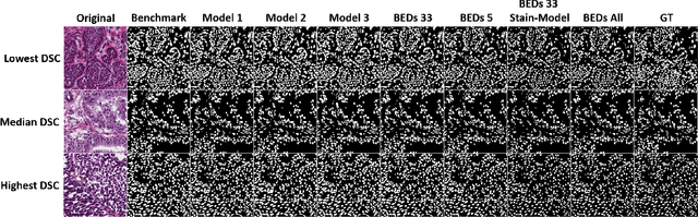 Figure 4 for BEDS: Bagging ensemble deep segmentation for nucleus segmentation with testing stage stain augmentation
