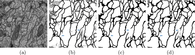Figure 3 for The Importance of Skip Connections in Biomedical Image Segmentation