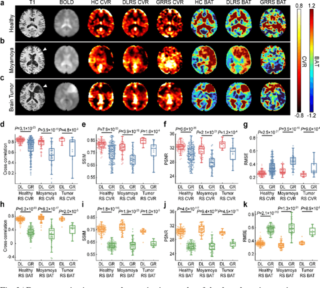 Figure 3 for Deep-learning-enabled Brain Hemodynamic Mapping Using Resting-state fMRI
