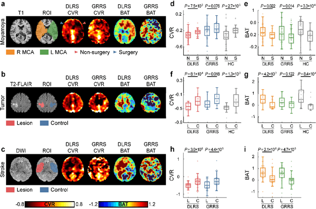 Figure 4 for Deep-learning-enabled Brain Hemodynamic Mapping Using Resting-state fMRI