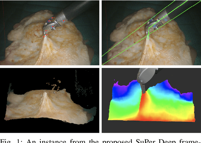 Figure 1 for SuPer Deep: A Surgical Perception Framework for Robotic Tissue Manipulation using Deep Learning for Feature Extraction