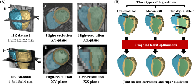 Figure 1 for Joint Motion Correction and Super Resolution for Cardiac Segmentation via Latent Optimisation