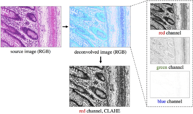Figure 3 for Semantic Segmentation of Colon Glands with Deep Convolutional Neural Networks and Total Variation Segmentation