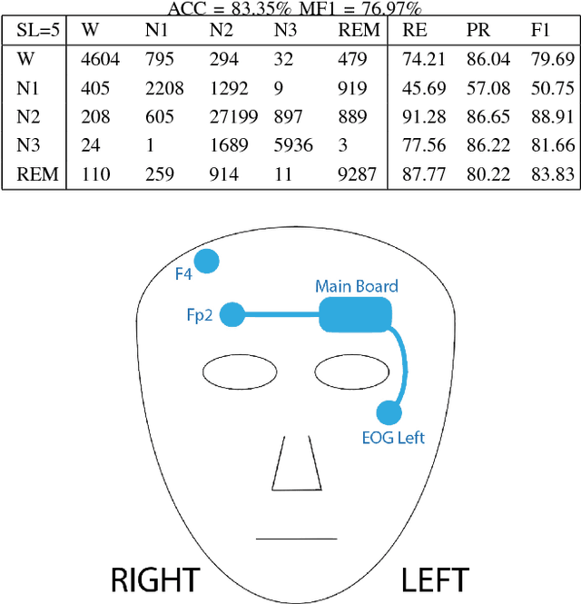 Figure 4 for Mixed Neural Network Approach for Temporal Sleep Stage Classification