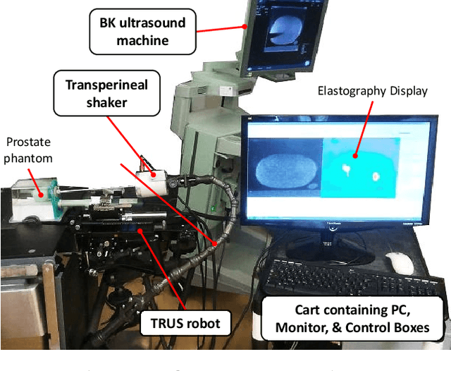 Figure 1 for Quasi-Real Time Multi-Frequency 3D Shear Wave Absolute Vibro-Elastography (S-WAVE) System for Prostate