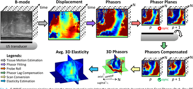 Figure 3 for Quasi-Real Time Multi-Frequency 3D Shear Wave Absolute Vibro-Elastography (S-WAVE) System for Prostate